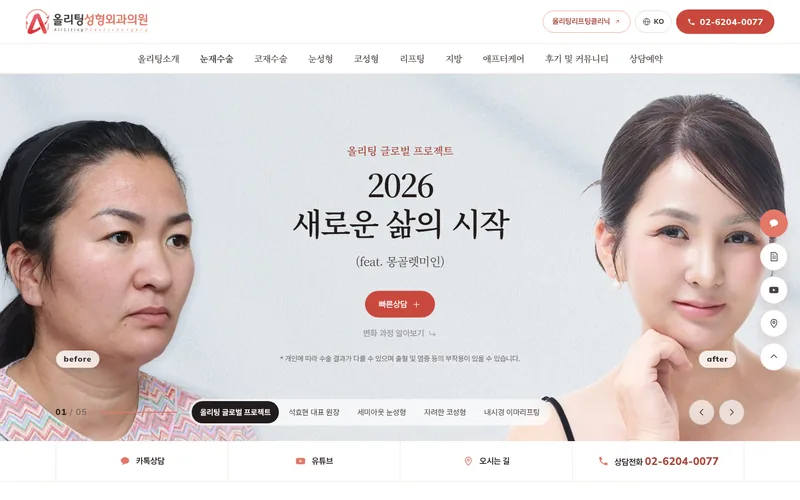 올리팅성형외과 리뉴얼 미리보기 첫 화면