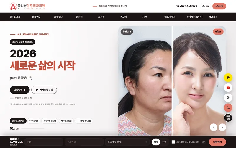 올리팅성형외과 리뉴얼 시안 2 첫 화면