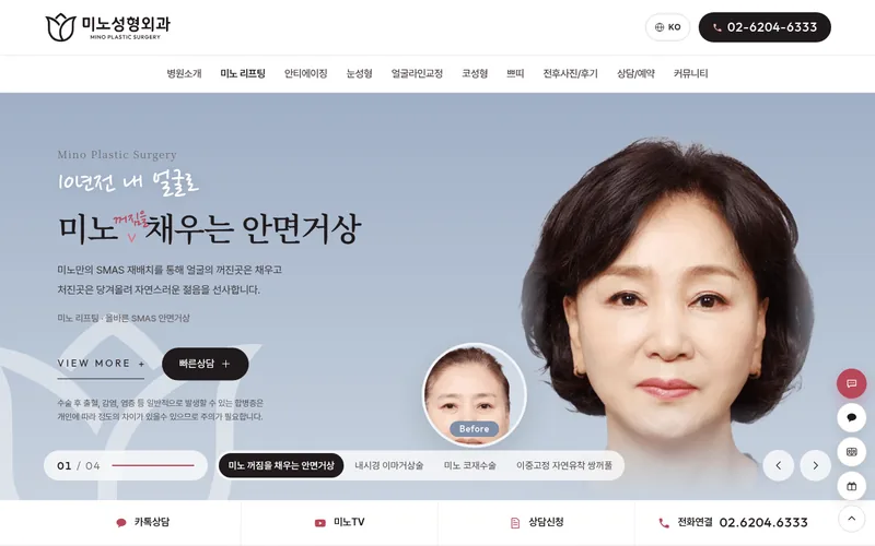미노성형외과 리뉴얼 미리보기 첫 화면