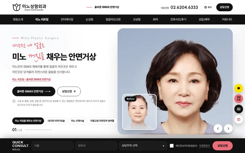 미노성형외과 리뉴얼 시안 2 첫 화면