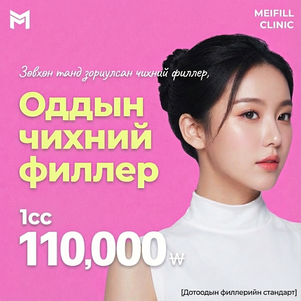 Сүүлийн үеийн трэнд, Idol чихний филлер - Эльф чих, дагина, Тинкербелл, Айдол, наалдсан чих, дэлдэн чих, гэдэс чихний филлер