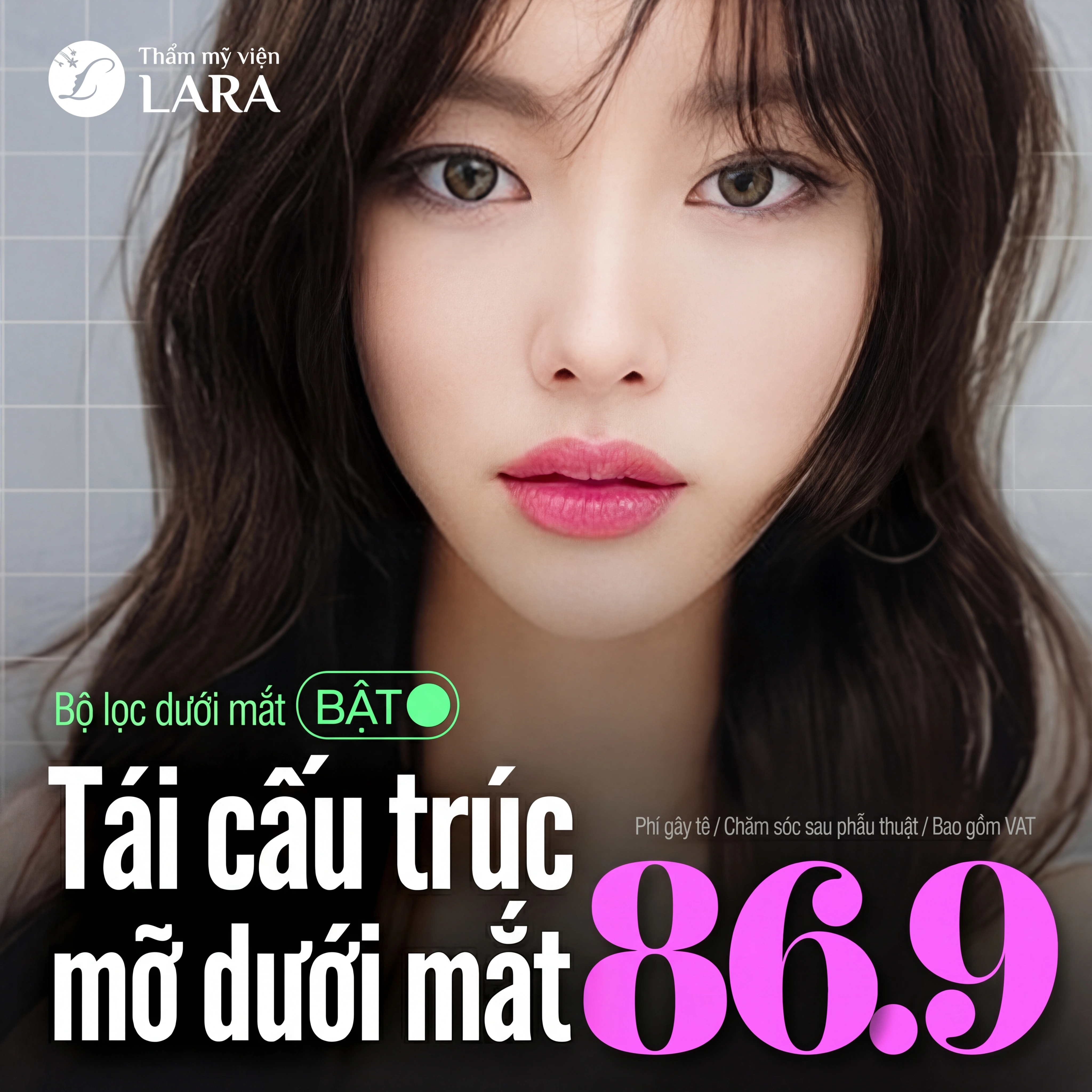 Lara_Tái bố trí mỡ bọng mắt cho vùng dưới mắt sáng ngời